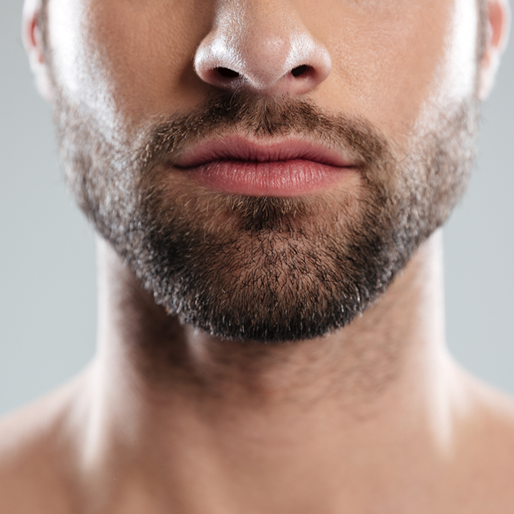Beard Mustache Eyebrow Transplantation